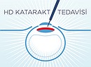 Katarakt Nedir Tedavisi Nasıl Yapılır?